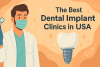 The Best Dental Implant Clinics in the USA bikrisohoj